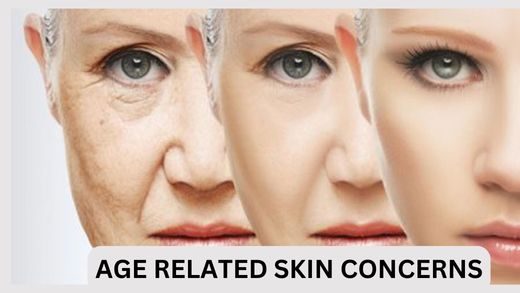 age related skin concerns
